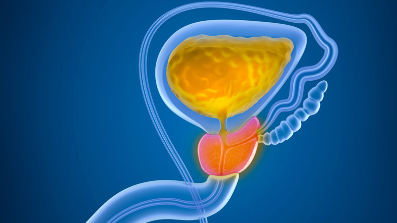 An Enlarged Prostate and Bladder